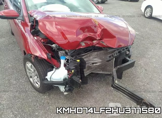 KMHD74LF2HU377580 фото 7