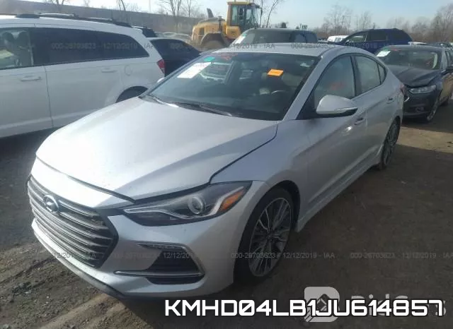 KMHD04LB1JU614857 фото 3