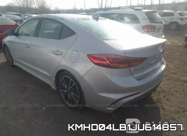 KMHD04LB1JU614857 фото 4