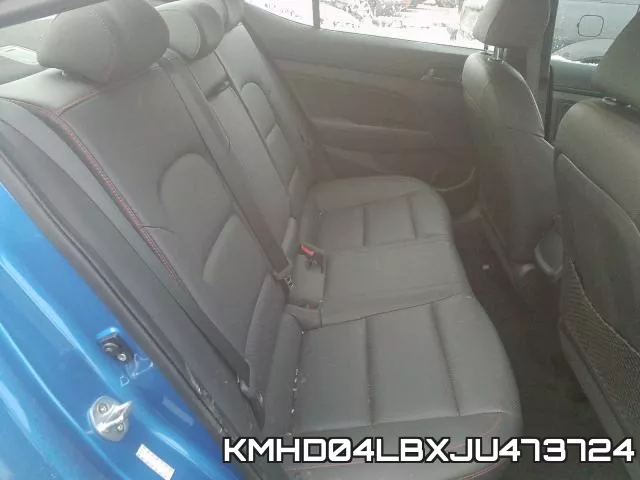 KMHD04LBXJU473724 фото 7