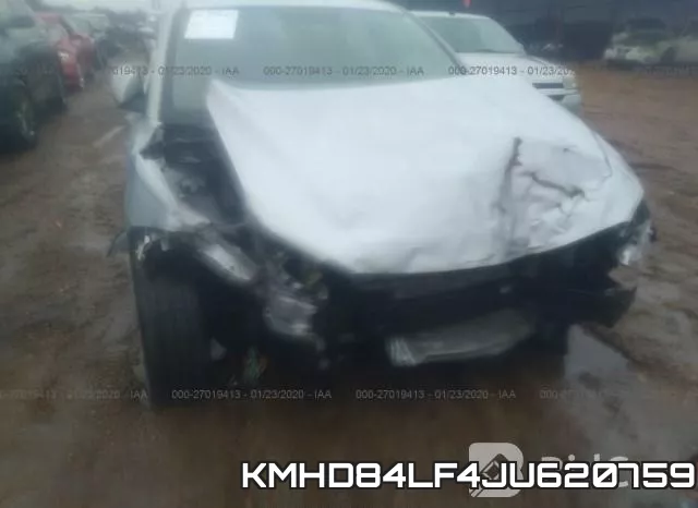 KMHD84LF4JU620759 фото 7