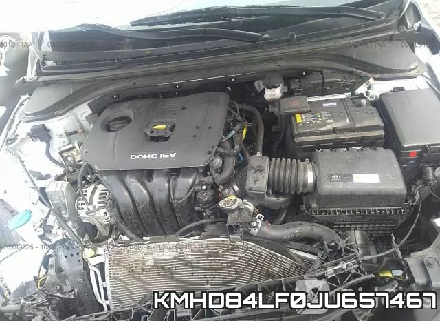 KMHD84LF0JU657467 фото 2