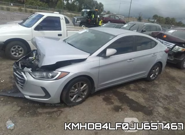 KMHD84LF0JU657467 фото 3