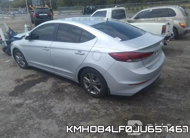 KMHD84LF0JU657467 фото 4