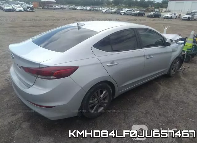 KMHD84LF0JU657467 фото 5