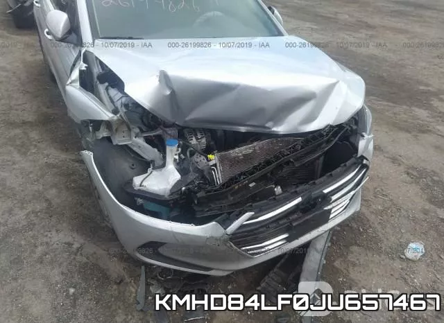 KMHD84LF0JU657467 фото 7
