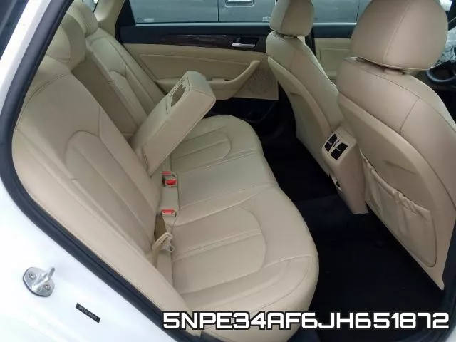 5NPE34AF6JH651872 фото 7