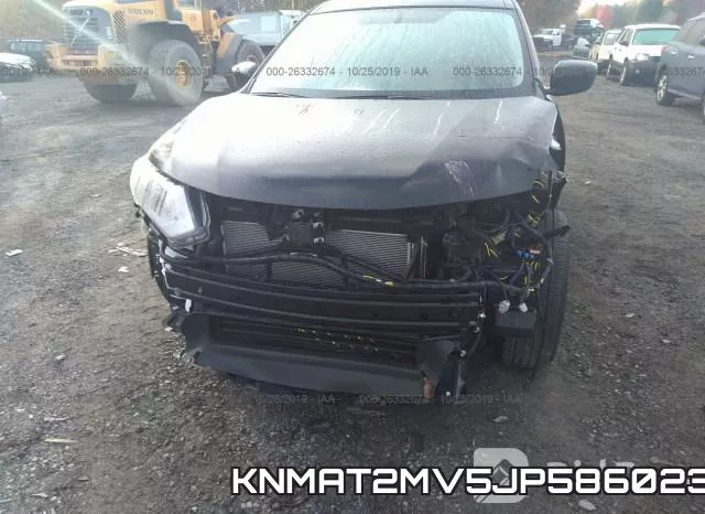 KNMAT2MV5JP586023 фото 7