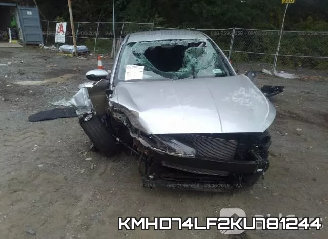 KMHD74LF2KU781244 фото 7