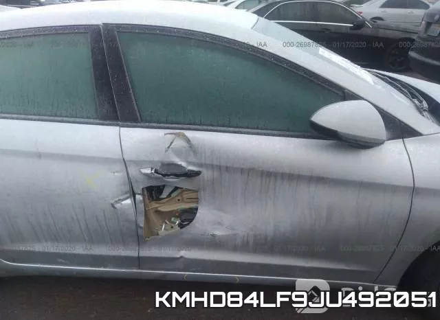 KMHD84LF9JU492051 фото 7