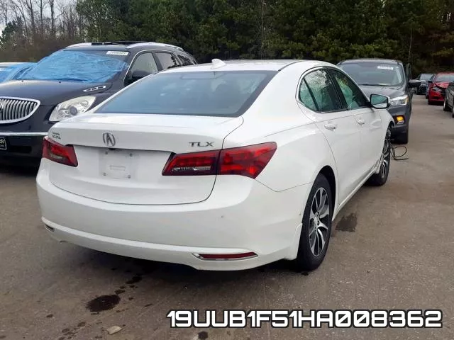19UUB1F51HA008362 фото 5