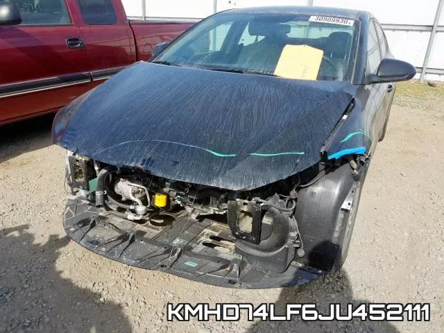 KMHD74LF6JU452111 фото 3