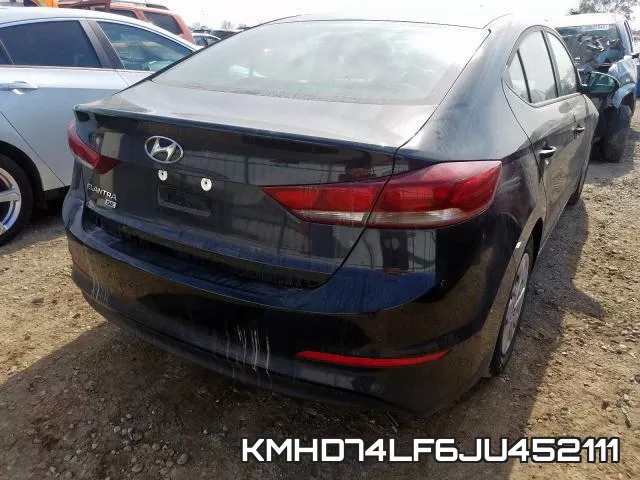 KMHD74LF6JU452111 фото 5
