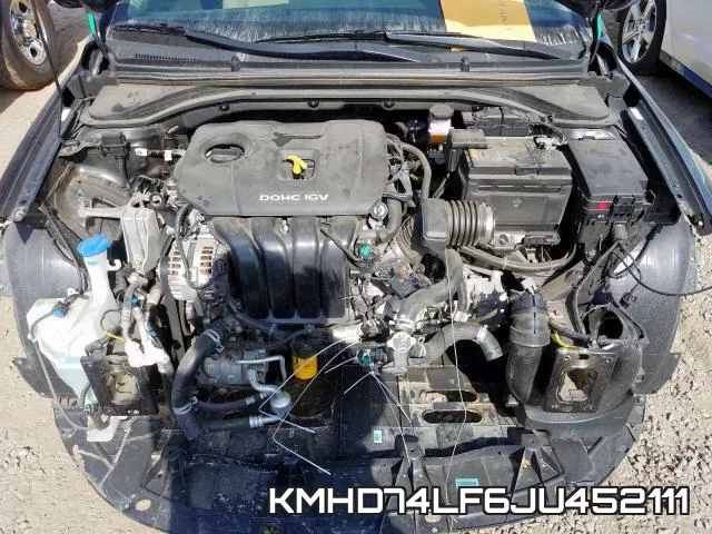 KMHD74LF6JU452111 фото 8