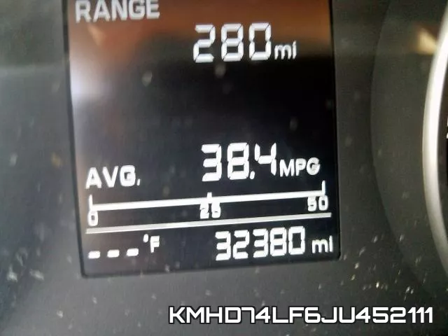 KMHD74LF6JU452111 фото 9