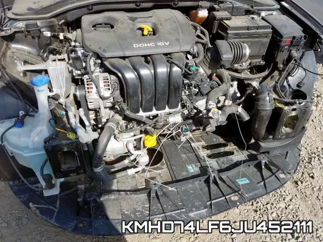 KMHD74LF6JU452111 фото 10