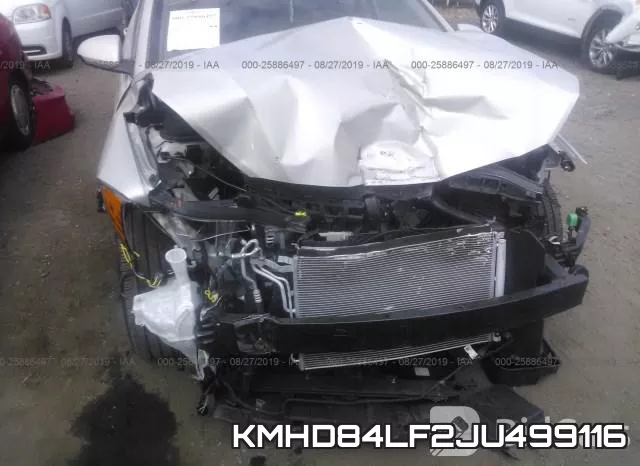 KMHD84LF2JU499116 фото 7