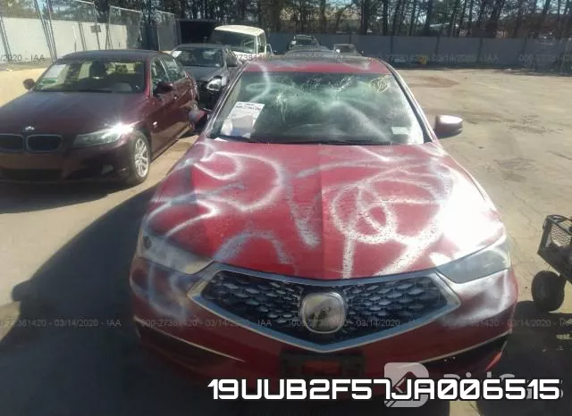 19UUB2F57JA006515 фото 7