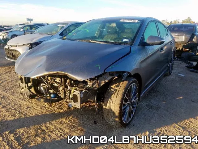 KMHD04LB7HU352594 фото 3