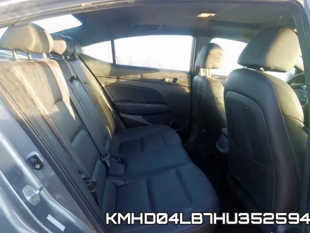 KMHD04LB7HU352594 фото 7