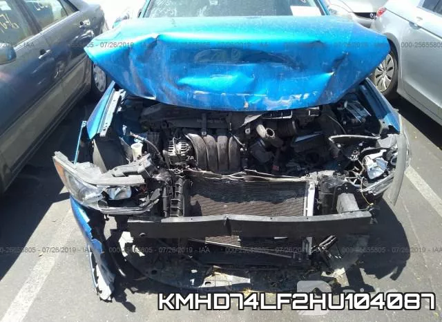 KMHD74LF2HU104087 фото 7