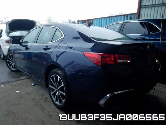 19UUB3F35JA006565 фото 4