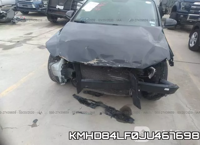 KMHD84LF0JU467698 фото 7