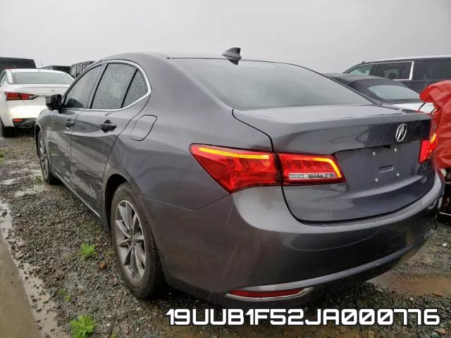 19UUB1F52JA000776 фото 4