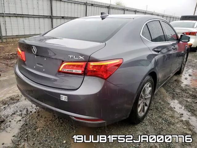 19UUB1F52JA000776 фото 5