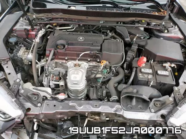 19UUB1F52JA000776 фото 8
