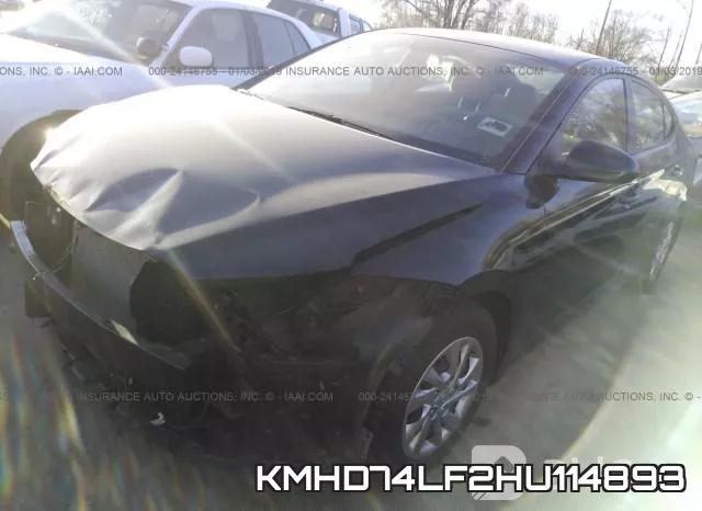 KMHD74LF2HU114893 фото 3