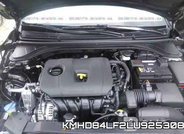 KMHD84LF2LU925308 фото 2