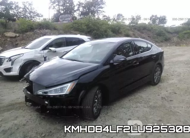KMHD84LF2LU925308 фото 3