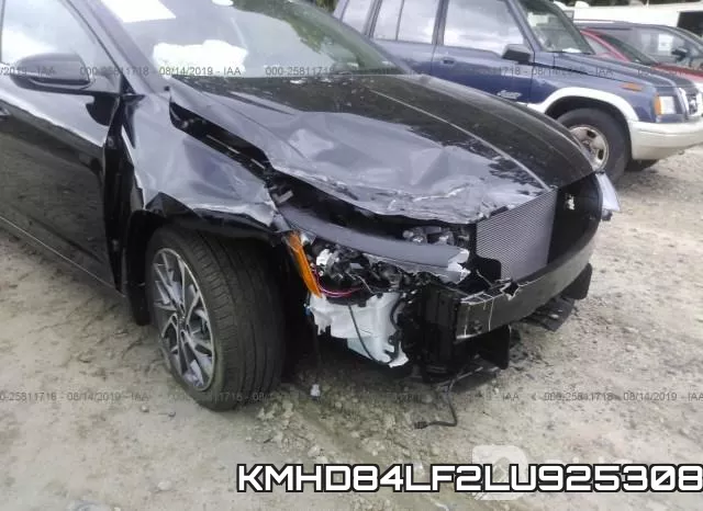 KMHD84LF2LU925308 фото 7
