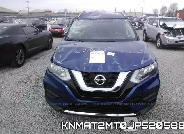 KNMAT2MT0JP520588 фото 7