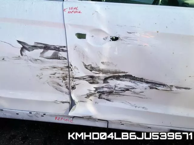KMHD04LB6JU539671 фото 10