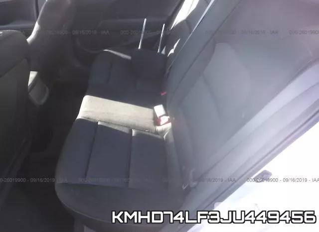 KMHD74LF3JU449456 фото 9