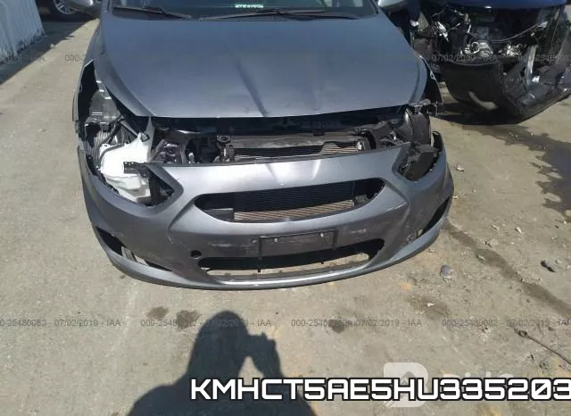 KMHCT5AE5HU335203 фото 7