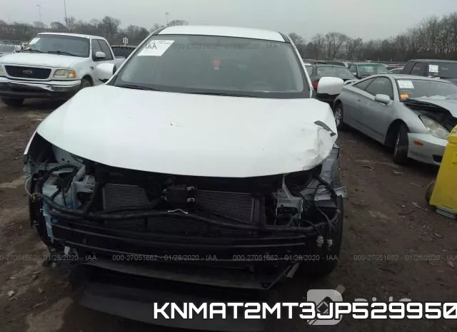 KNMAT2MT3JP529950 фото 7
