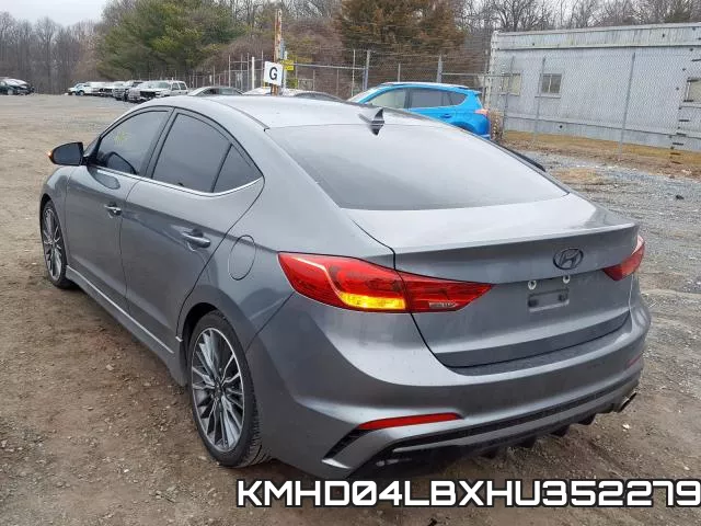 KMHD04LBXHU352279 фото 4