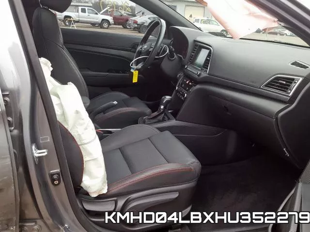 KMHD04LBXHU352279 фото 6