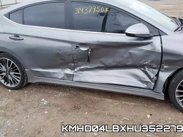 KMHD04LBXHU352279 фото 10