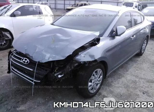 KMHD74LF6JU607000 фото 3