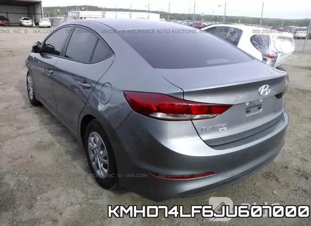 KMHD74LF6JU607000 фото 4