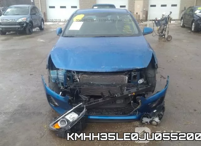 KMHH35LE0JU055200 фото 7
