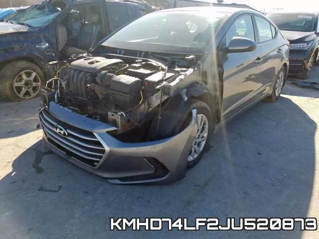 KMHD74LF2JU520873 фото 3