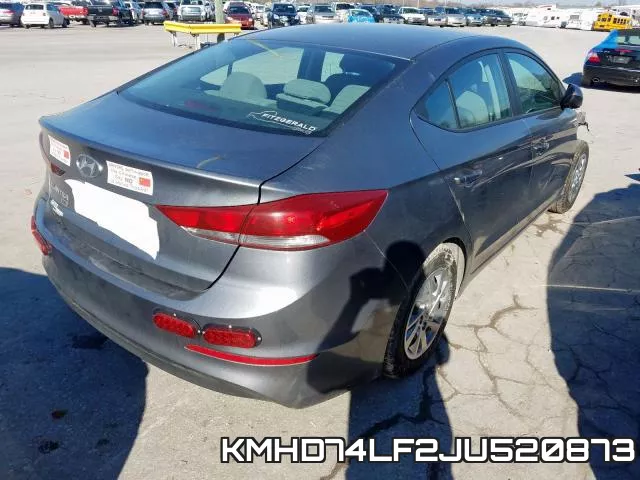KMHD74LF2JU520873 фото 5