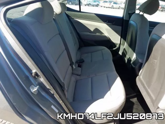 KMHD74LF2JU520873 фото 7