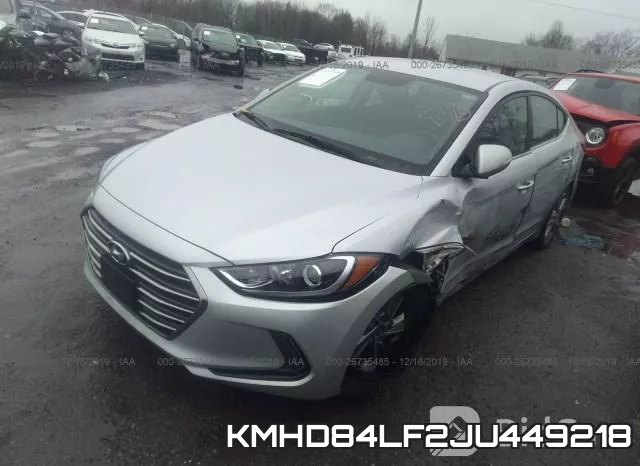 KMHD84LF2JU449218 фото 3