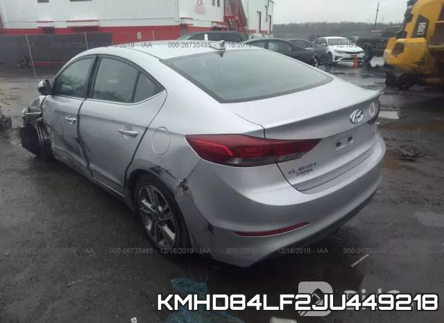 KMHD84LF2JU449218 фото 4